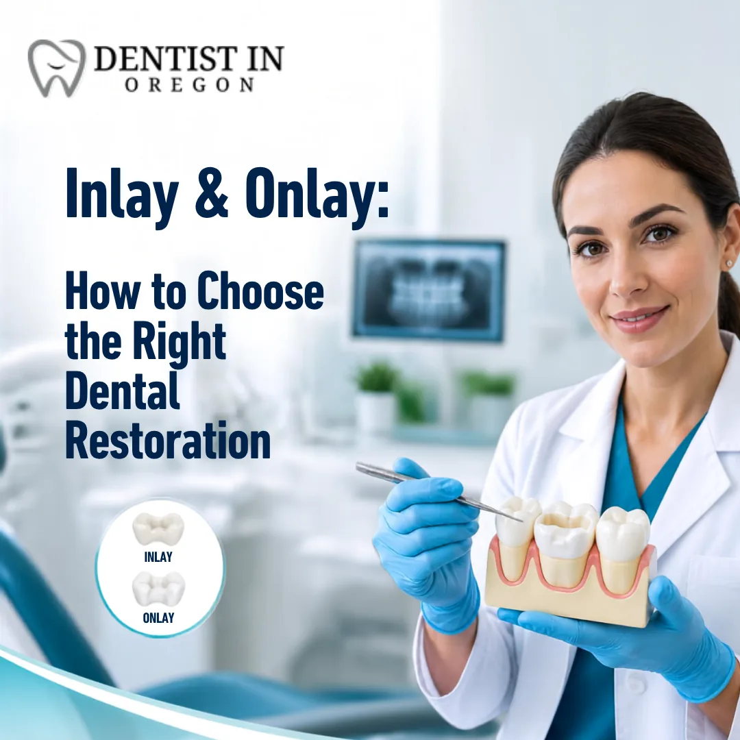 Inlay & Onlay: How to Choose the Right Dental Restoration